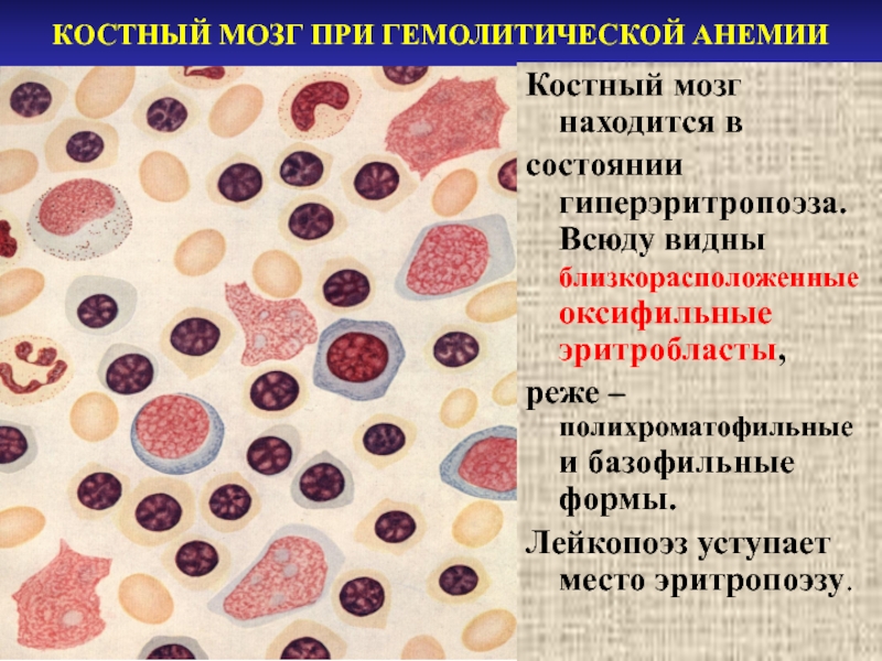 Костный мозг при анемии